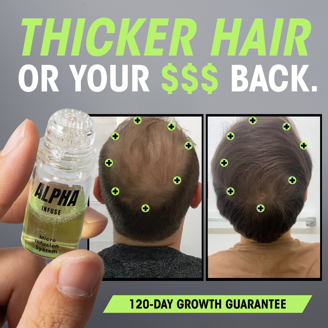 AlphaInfuse Microneedling Hair Regrowth System – Made with Panax Ginseng, Eclipta Prostrata, Peppermint & Ginger Root, Infused Deep into Your Scalp to Stop Hair Loss and Regrow Thicker Hair in 4 Weeks