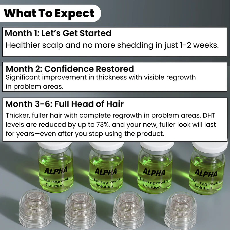 AlphaInfuse Microneedling Hair Regrowth System – Made with Panax Ginseng, Eclipta Prostrata, Peppermint & Ginger Root, Infused Deep into Your Scalp to Stop Hair Loss and Regrow Thicker Hair in 4 Weeks